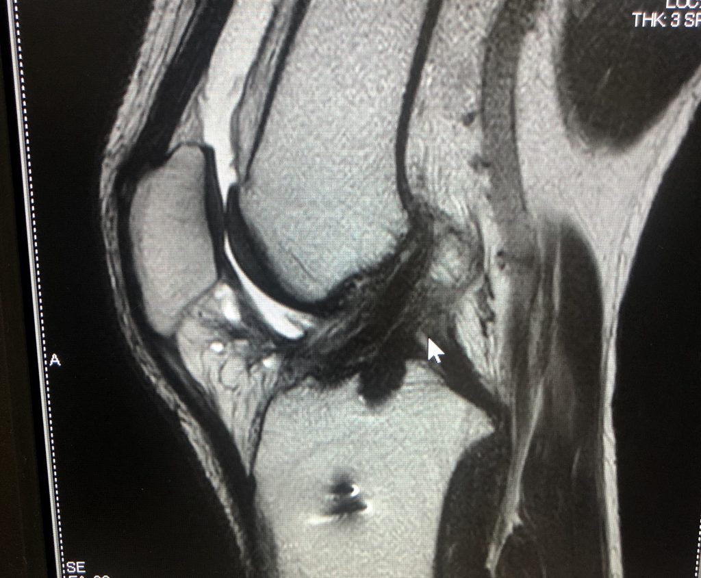 E950C425-65D5-46CF-A827-E1A58D74E1EB